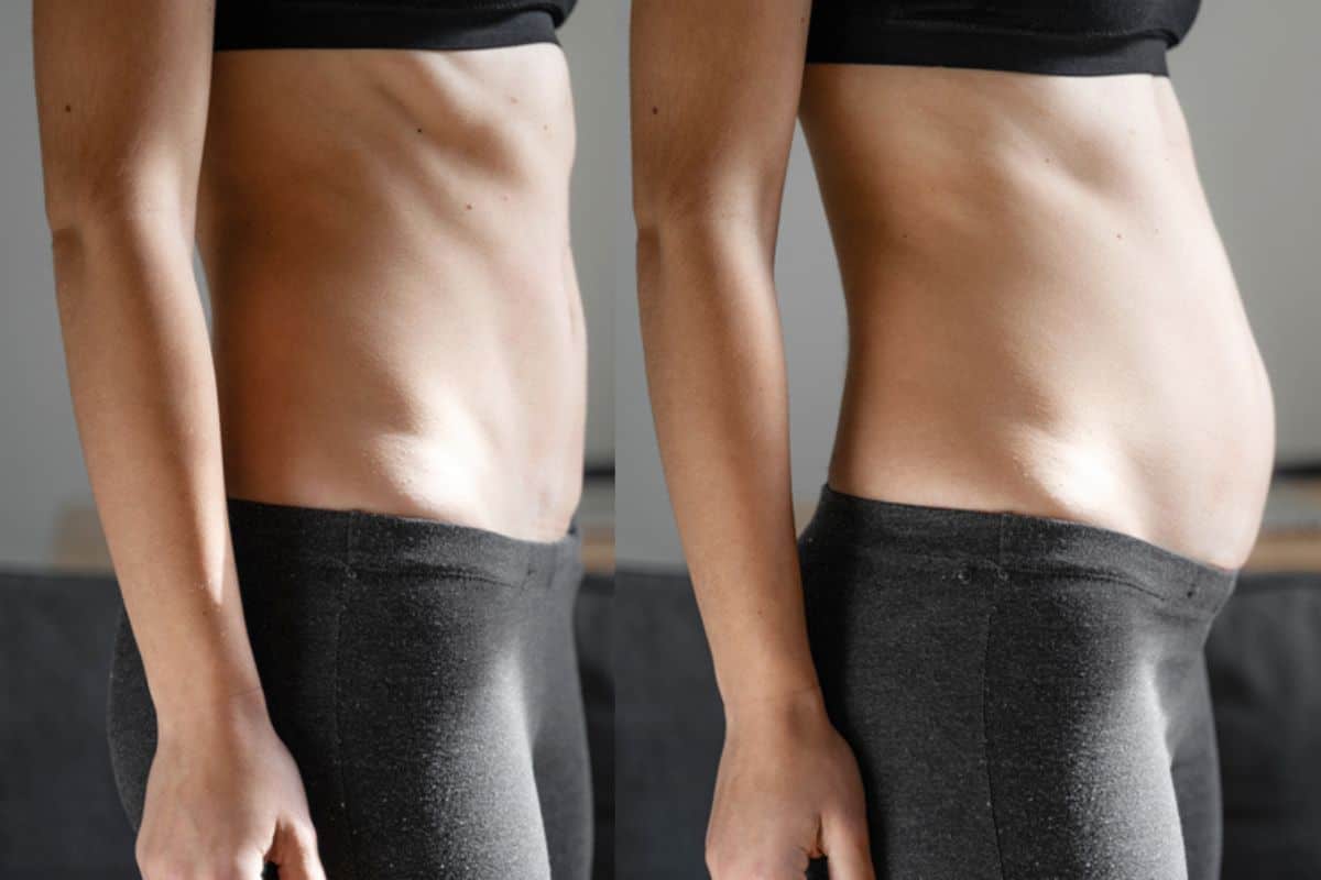 How long does diastasis recti take to improve Warwick?