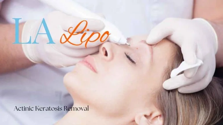 Woman receiving Actinic Keratosis Removal Treatment Warwick