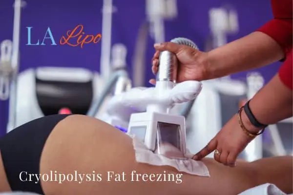 women getting fat freezing Warwick