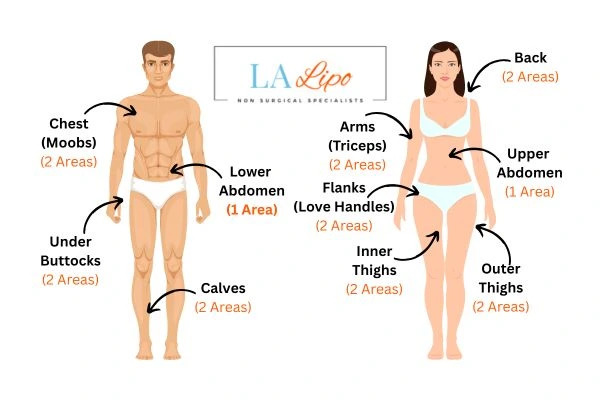 LA LIPO Cryolipolysis Areas Warwick