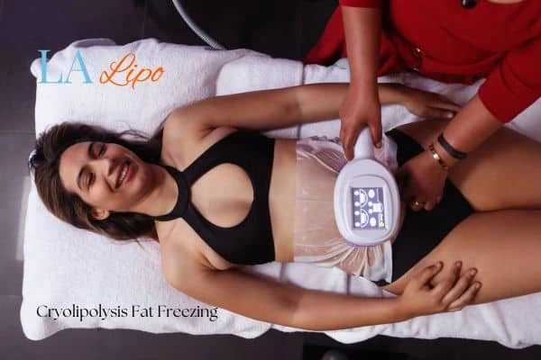 woman getting cryolipolysis Warwick