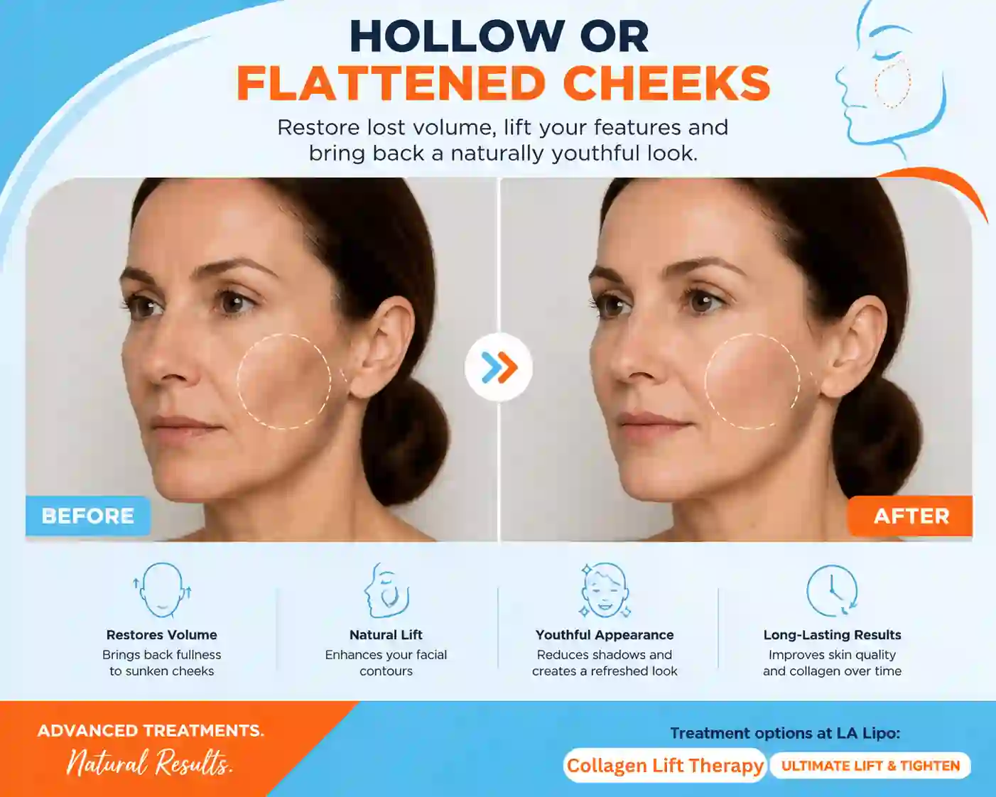 Sign #4: Hollow or Flattened Cheeks Warwick