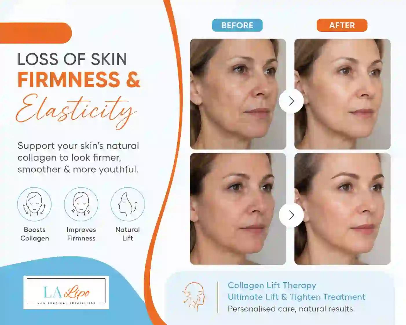 Sign #7: Loss of Skin Firmness and Elasticity Warwick